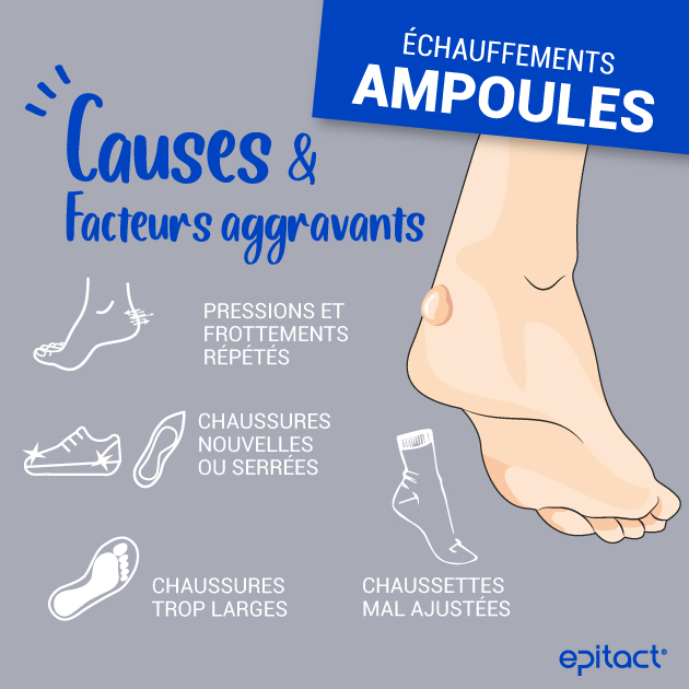 Formation d'une ampoule, signe d'infection d’une ampoule quand